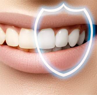 Tooth Whitening